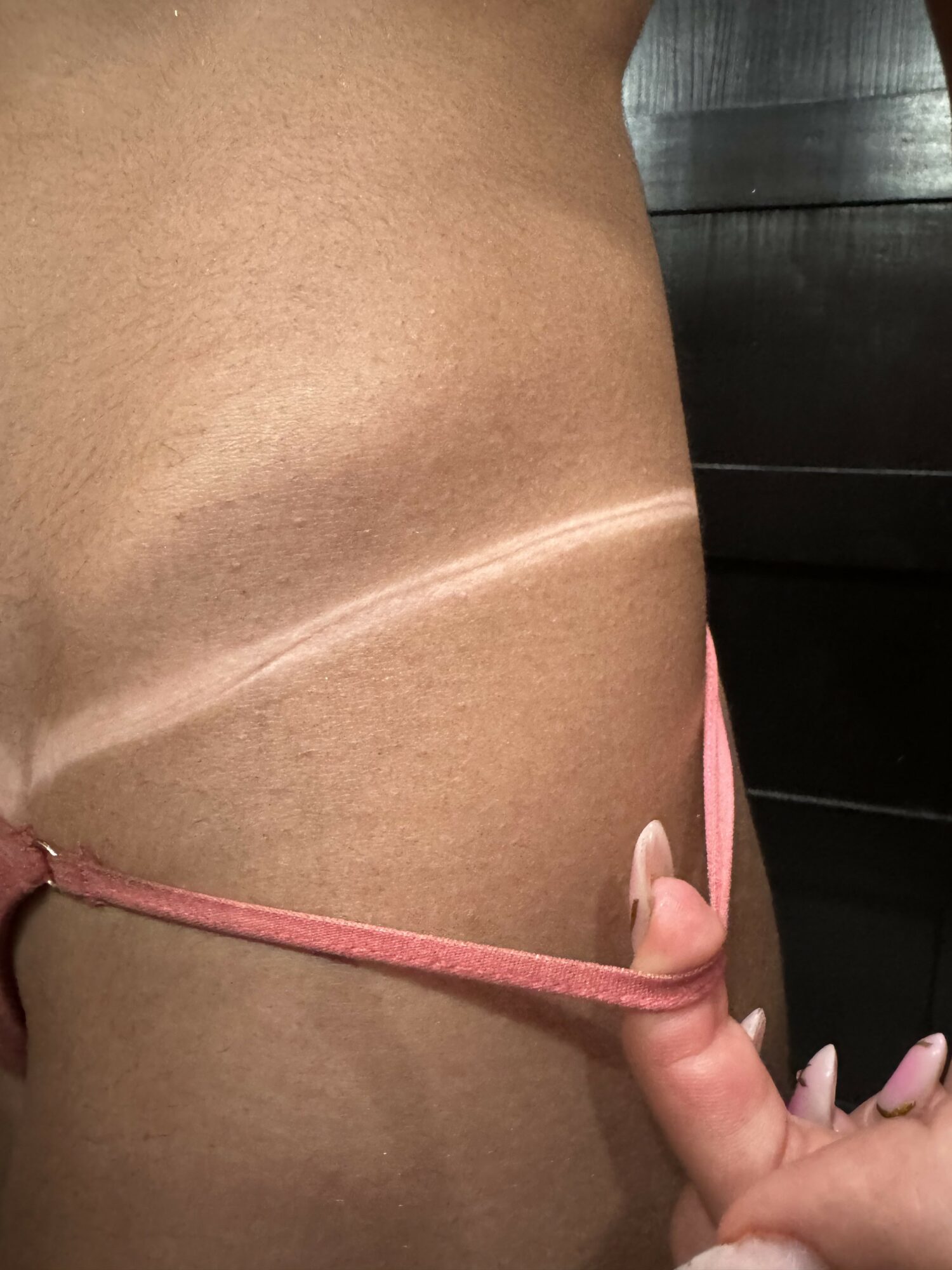 Close-up of a person's side showing a horizontal scar and a hand with long nails touching the skin.
