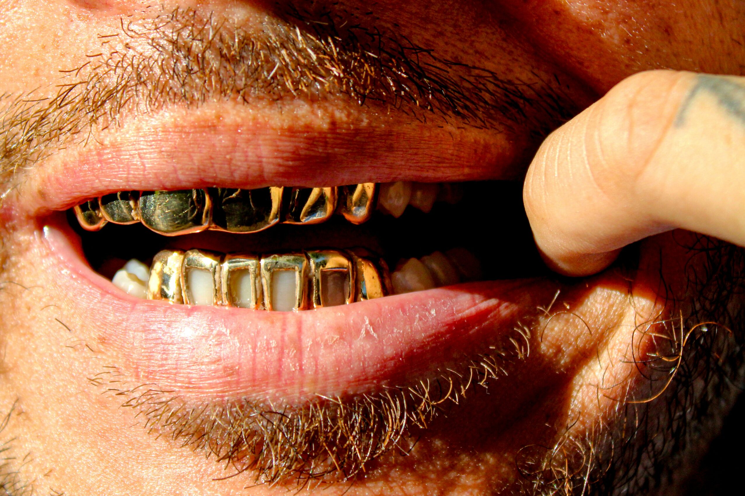 Close-up of a person's mouth showing gold teeth and a beard, with a finger pulling the lip aside.