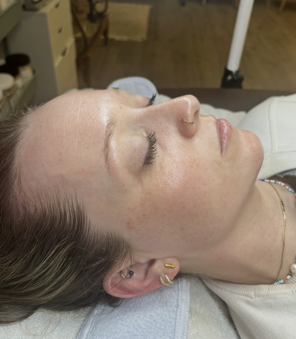 Side view of a woman lying down with eyes closed, showing her face and ear with jewelry, in a clinical setting.
