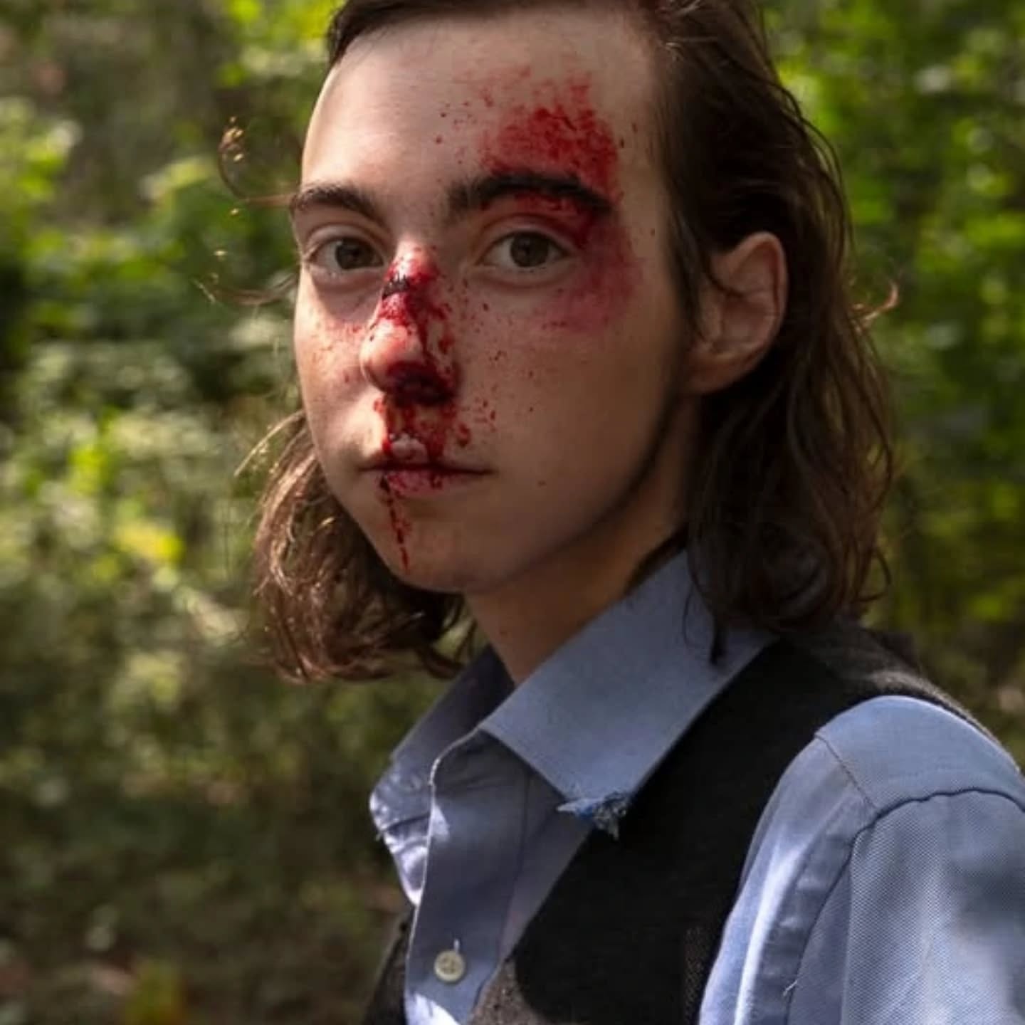 Young person with blood on face and nose, outdoors with green foliage background.