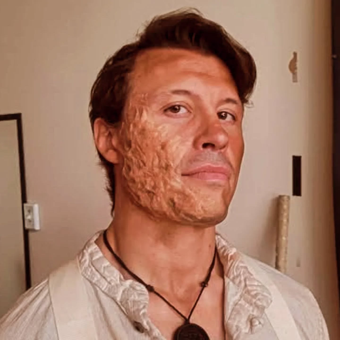 Man with a serious expression, wearing a light-colored shirt and a necklace, standing indoors with a textured skin condition on one side of his face.