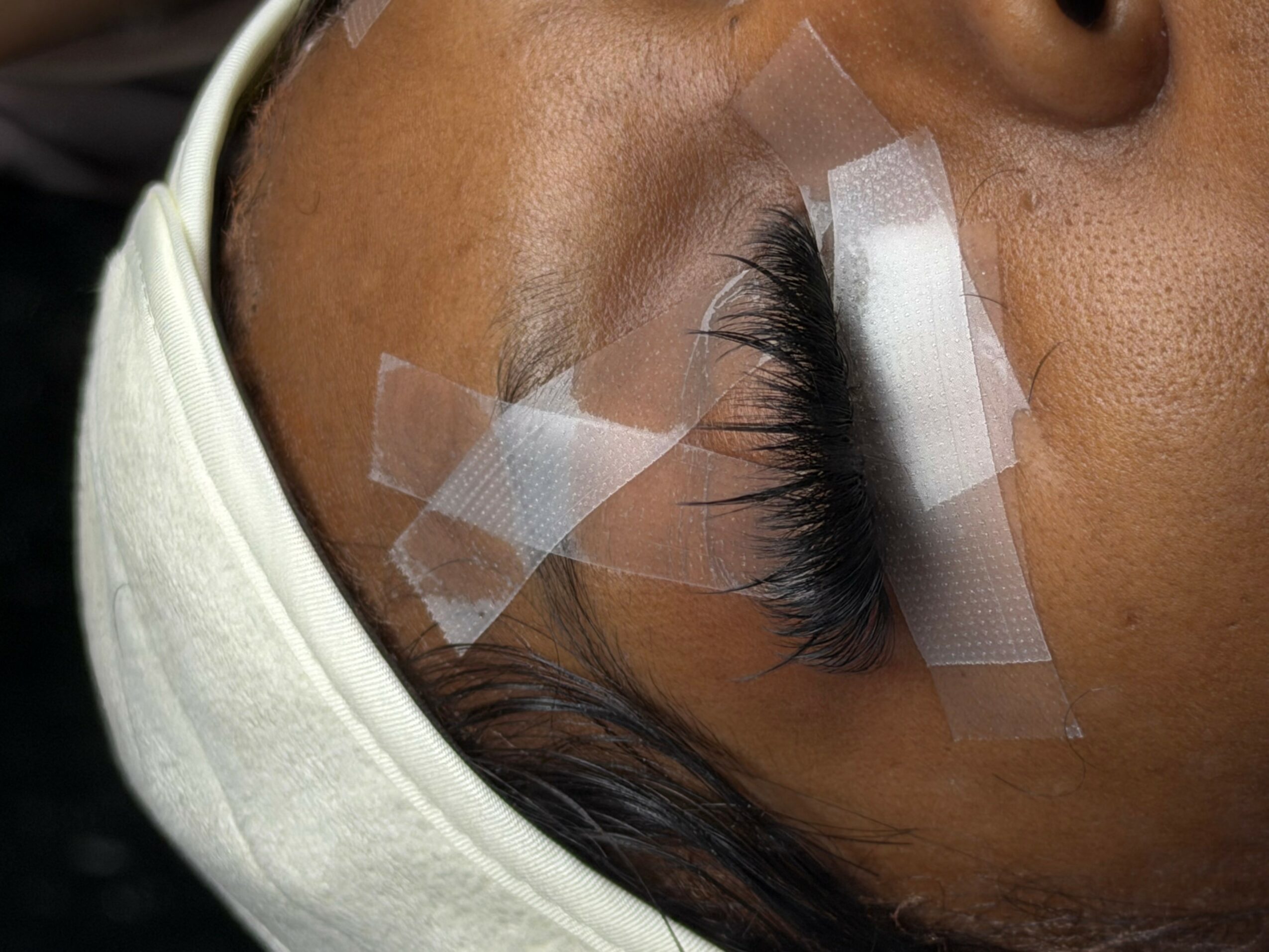 Person with closed eye, eyelash extension, and medical tape near eye, wearing a white headband.