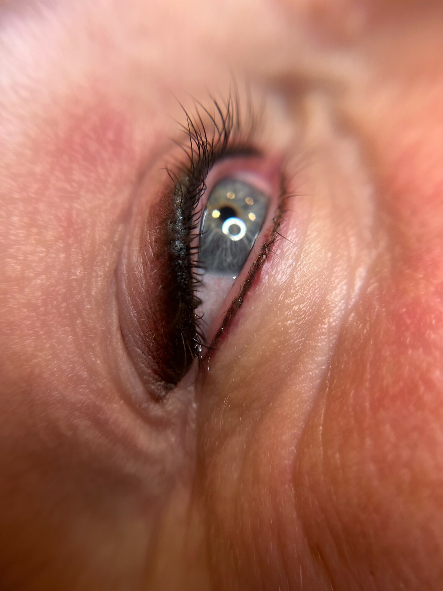 Close-up of a person's eye looking upward, showing eyelashes, eyelid, and surrounding skin.