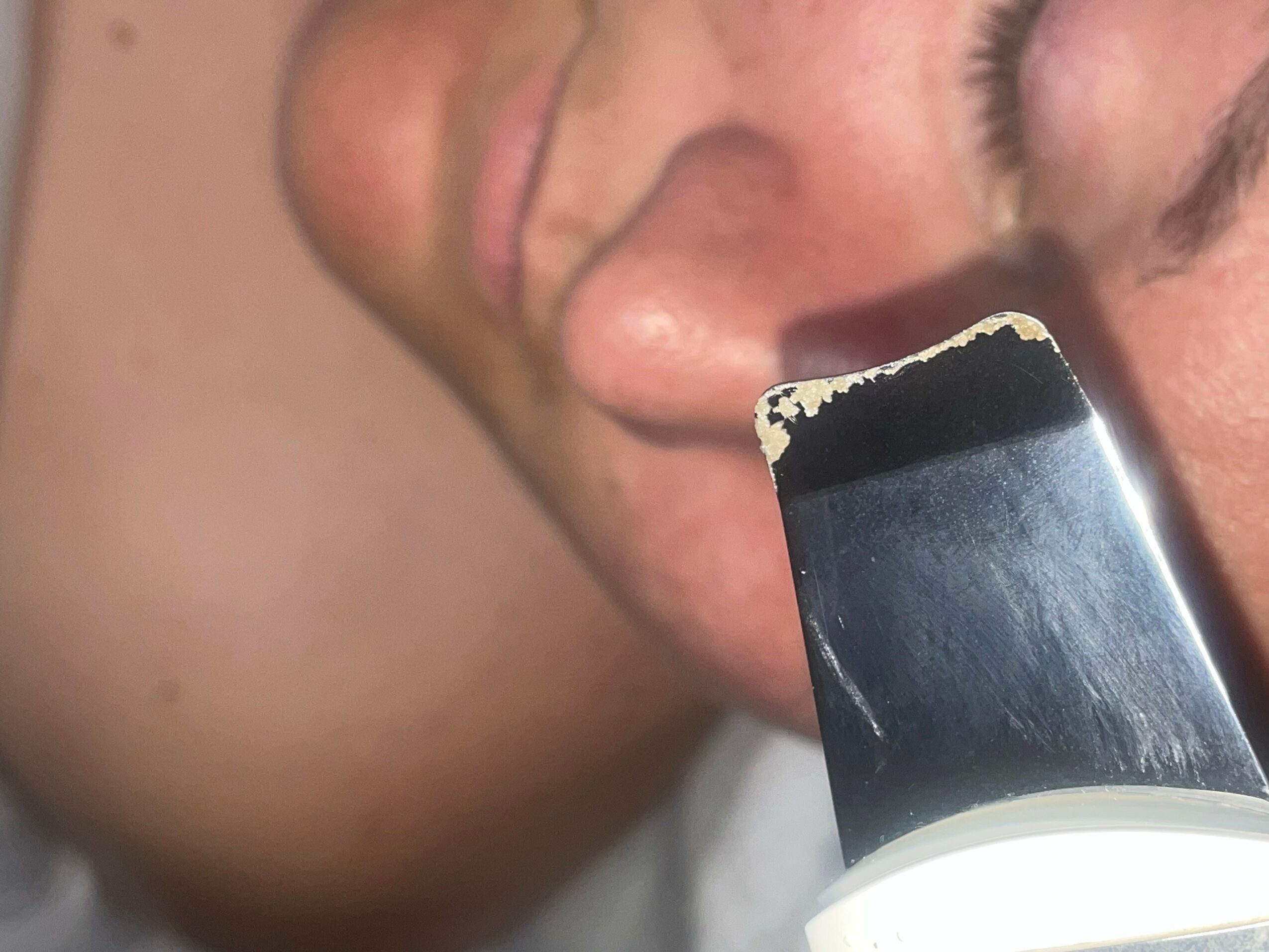 Close-up of a smiling person's face with a black and white object near their cheek.
