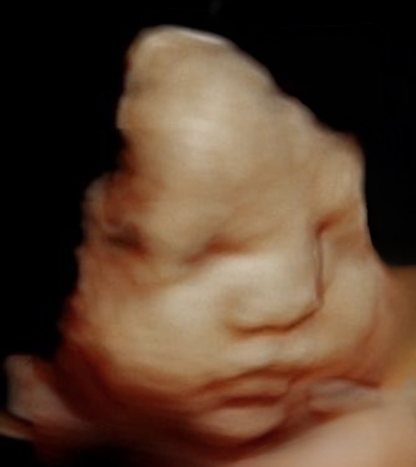 Unclear image of a fetus or baby with a blurred face, dark background, and soft lighting.