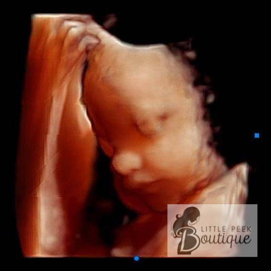 Upright 3D ultrasound image of a fetus with closed eyes and hand near face, in warm tones.