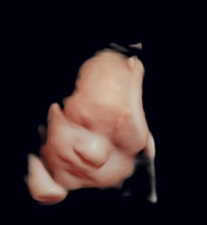 Close-up of a fetus's face and hand, with dark background, showing detailed features.