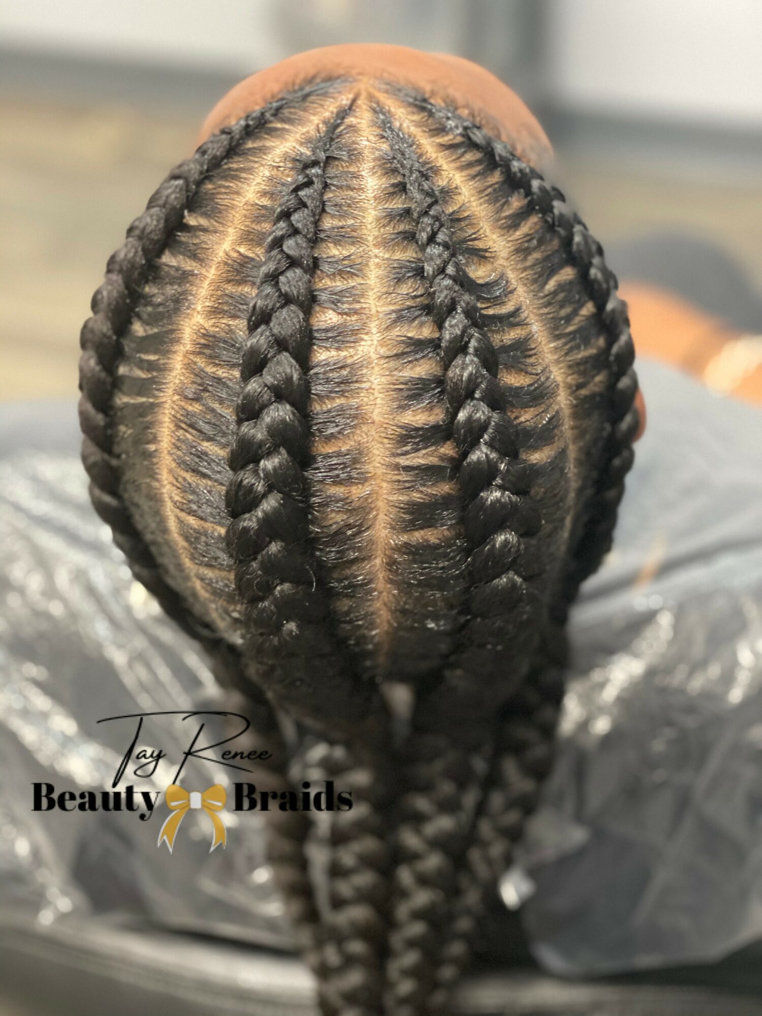 Top view of a person's head with neatly braided hair in multiple sections, showing scalp and braids.